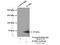 Peptidyl Arginine Deiminase 4 antibody, 17373-1-AP, Proteintech Group, Immunoprecipitation image 