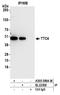 Tetratricopeptide Repeat Domain 4 antibody, A305-599A-M, Bethyl Labs, Immunoprecipitation image 