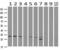 Cyclin-dependent kinase 5 antibody, GTX84696, GeneTex, Western Blot image 