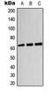 Dihydropyrimidinase-related protein 4 antibody, GTX55228, GeneTex, Western Blot image 