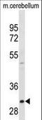 ZW10 Interacting Kinetochore Protein antibody, LS-C160979, Lifespan Biosciences, Western Blot image 