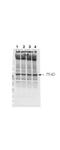 Neurofibromin 2 antibody, P00279, Boster Biological Technology, Western Blot image 