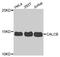 Calcitonin Related Polypeptide Beta antibody, PA5-76342, Invitrogen Antibodies, Western Blot image 