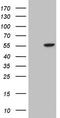 Integrin Linked Kinase antibody, CF804883, Origene, Western Blot image 