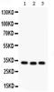 Complement C1q Binding Protein antibody, PA5-78890, Invitrogen Antibodies, Western Blot image 