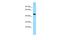 Lipase Family Member N antibody, A13189, Boster Biological Technology, Western Blot image 