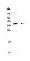 Cone-Rod Homeobox antibody, A02202-1, Boster Biological Technology, Western Blot image 