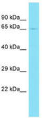 ArfGAP With GTPase Domain, Ankyrin Repeat And PH Domain 11 antibody, TA333549, Origene, Western Blot image 