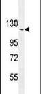 Rho GTPase Activating Protein 17 antibody, PA5-24250, Invitrogen Antibodies, Western Blot image 