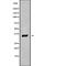 NFAT Activating Protein With ITAM Motif 1 antibody, abx217148, Abbexa, Western Blot image 
