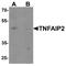 Tumor necrosis factor alpha-induced protein 2 antibody, A10874, Boster Biological Technology, Western Blot image 