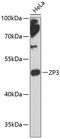 Zona Pellucida Glycoprotein 3 antibody, 14-824, ProSci, Western Blot image 