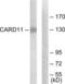 Caspase Recruitment Domain Family Member 11 antibody, LS-C119427, Lifespan Biosciences, Western Blot image 