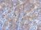 Inhibitor Of Nuclear Factor Kappa B Kinase Subunit Beta antibody, NBP1-32258, Novus Biologicals, Immunohistochemistry frozen image 