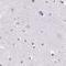 Peripherin antibody, NBP2-38444, Novus Biologicals, Immunohistochemistry paraffin image 