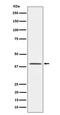 NK2 Homeobox 1 antibody, M01322-3, Boster Biological Technology, Western Blot image 