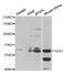 Galactosidase Beta 1 antibody, MBS127071, MyBioSource, Western Blot image 