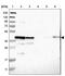 Starch Binding Domain 1 antibody, PA5-52884, Invitrogen Antibodies, Western Blot image 