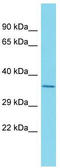 Ankyrin Repeat Domain 53 antibody, TA330759, Origene, Western Blot image 