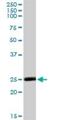 Methionine Sulfoxide Reductase A antibody, H00004482-D01P, Novus Biologicals, Western Blot image 