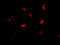 Metastasis Associated 1 Family Member 2 antibody, 56227, QED Bioscience, Immunofluorescence image 