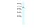 General Transcription Factor IIE Subunit 1 antibody, GTX49059, GeneTex, Western Blot image 