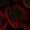 Kyphoscoliosis Peptidase antibody, HPA036492, Atlas Antibodies, Immunofluorescence image 