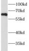 Hyaluronidase 4 antibody, FNab04090, FineTest, Western Blot image 