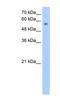 Nudix Hydrolase 12 antibody, NBP1-52974, Novus Biologicals, Western Blot image 