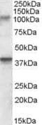 Glutamate Ionotropic Receptor Kainate Type Subunit 3 antibody, PA5-18964, Invitrogen Antibodies, Western Blot image 