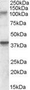 Glutamate Ionotropic Receptor Kainate Type Subunit 3 antibody, PA5-18964, Invitrogen Antibodies, Western Blot image 