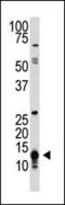 Small Ubiquitin Like Modifier 1 antibody, PA5-11372, Invitrogen Antibodies, Western Blot image 