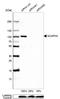 Non-SMC Condensin II Complex Subunit H2 antibody, NBP2-49580, Novus Biologicals, Western Blot image 