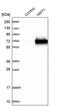 N-Myristoyltransferase 1 antibody, PA5-54643, Invitrogen Antibodies, Western Blot image 