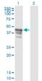 Polyadenylate-binding protein-interacting protein 1 antibody, H00010605-M04, Novus Biologicals, Western Blot image 