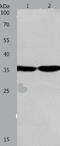 Pad1 antibody, TA321727, Origene, Western Blot image 