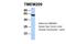 Transmembrane Protein 209 antibody, 27-210, ProSci, Western Blot image 