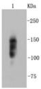Integrin Subunit Beta 1 antibody, NBP2-67312, Novus Biologicals, Western Blot image 