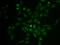 Selectin P Ligand antibody, STJ25471, St John