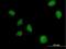 MAP3K7 C-Terminal Like antibody, H00056911-B01P, Novus Biologicals, Immunocytochemistry image 