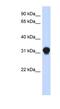 Dynein Axonemal Light Intermediate Chain 1 antibody, NBP1-56390, Novus Biologicals, Western Blot image 