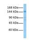 Cell Migration Inducing Hyaluronidase 1 antibody, GTX47001, GeneTex, Western Blot image 