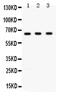 Checkpoint Kinase 2 antibody, PA5-79041, Invitrogen Antibodies, Western Blot image 