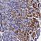 Coiled-Coil Domain Containing 22 antibody, HPA000888, Atlas Antibodies, Immunohistochemistry frozen image 