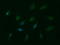 Protein Tyrosine Kinase 2 antibody, LS-C788085, Lifespan Biosciences, Immunofluorescence image 