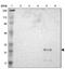 Ankyrin Repeat And SOCS Box Containing 6 antibody, NBP1-86141, Novus Biologicals, Western Blot image 