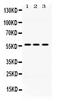 Aldehyde dehydrogenase X, mitochondrial antibody, PB10037, Boster Biological Technology, Western Blot image 