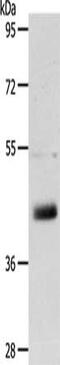 Lymphatic Vessel Endothelial Hyaluronan Receptor 1 antibody, CSB-PA561582, Cusabio, Western Blot image 