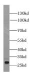 Interleukin 17D antibody, FNab04227, FineTest, Western Blot image 