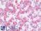 Galactosidase Beta 1 antibody, LS-B10217, Lifespan Biosciences, Immunohistochemistry paraffin image 